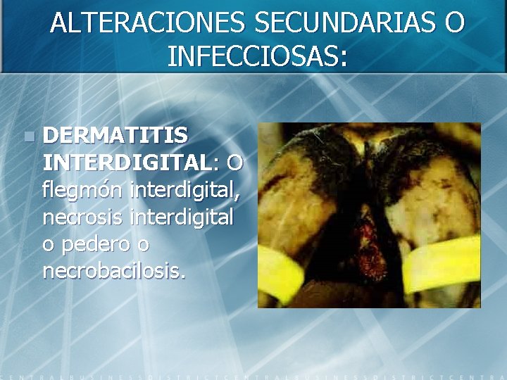 ALTERACIONES SECUNDARIAS O INFECCIOSAS: n DERMATITIS INTERDIGITAL: O flegmón interdigital, necrosis interdigital o pedero