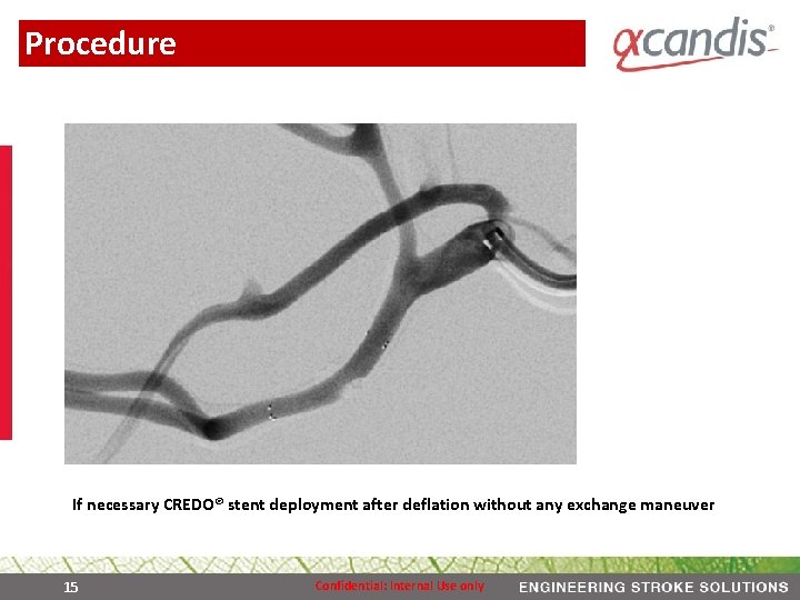 Procedure If necessary CREDO® stent deployment after deflation without any exchange maneuver 15 Confidential: