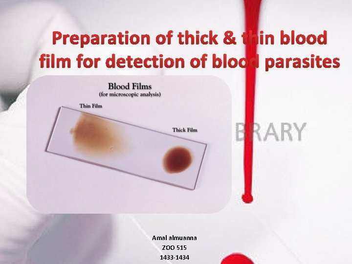 Preparation of thick & thin blood film for detection of blood parasites Amal almuanna