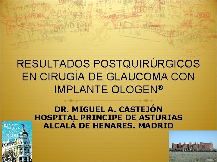 RESULTADOS POSTQUIRÚRGICOS EN CIRUGÍA DE GLAUCOMA CON IMPLANTE OLOGEN® DR. MIGUEL A. CASTEJÓN HOSPITAL