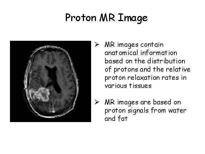 Proton MR Image Ø MR images contain anatomical information based on the distribution of