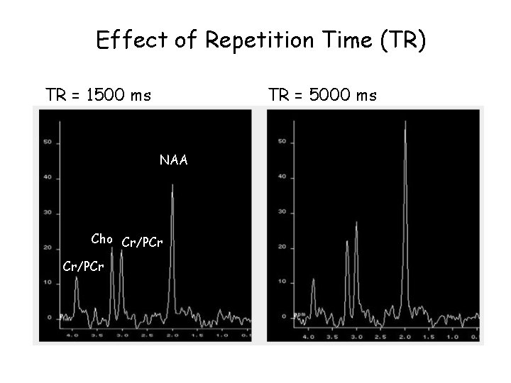 Effect of Repetition Time (TR) TR = 1500 ms TR = 5000 ms NAA