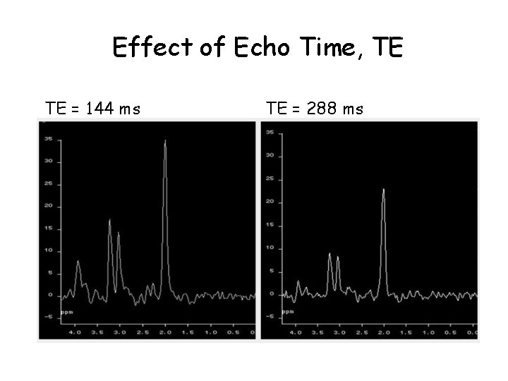 Effect of Echo Time, TE TE = 144 ms TE = 288 ms 