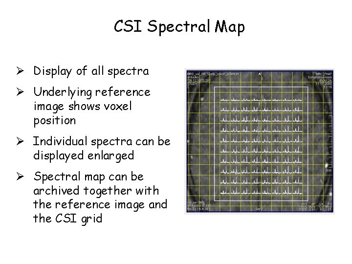 CSI Spectral Map Ø Display of all spectra Ø Underlying reference image shows voxel