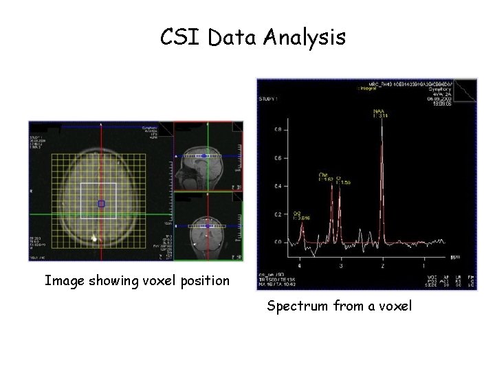 CSI Data Analysis Image showing voxel position Spectrum from a voxel 