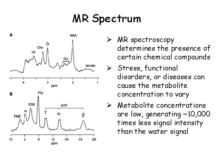 MR Spectrum Ø MR spectroscopy determines the presence of certain chemical compounds Ø Stress,