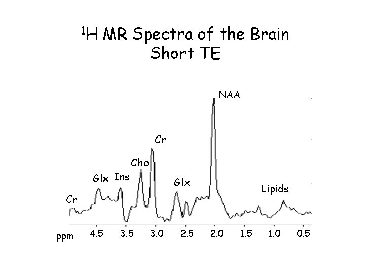 1 H MR Spectra of the Brain Short TE NAA Cr Glx Ins Cho