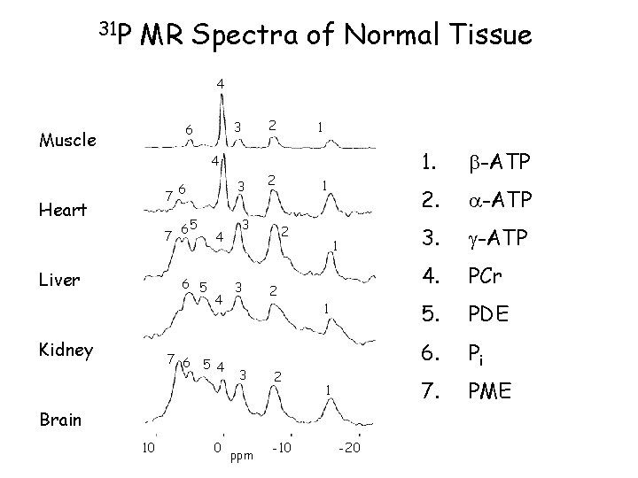 31 P MR Spectra of Normal Tissue 4 Muscle 2 3 6 1 4