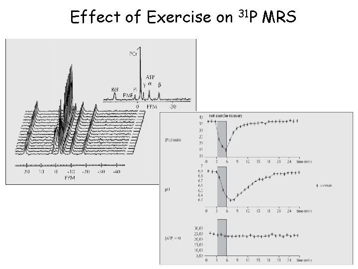 Effect of Exercise on 31 P MRS 