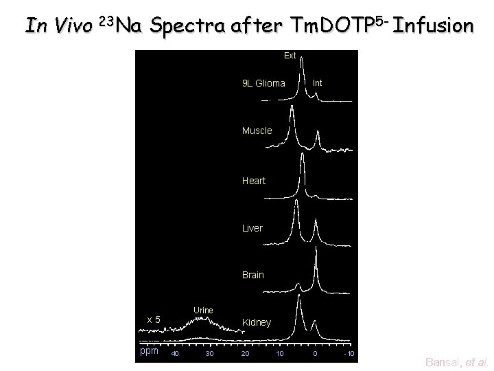 In Vivo 23 Na Spectra after Tm. DOTP 5 - Infusion Ext 9 L