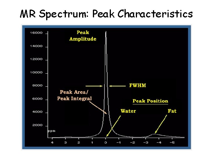 MR Spectrum: Peak Characteristics 