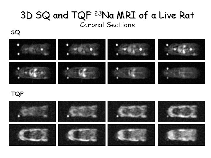 3 D SQ and TQF 23 Na MRI of a Live Rat SQ TQF