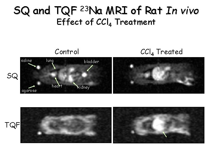 SQ and TQF 23 Na MRI of Rat In vivo Effect of CCl 4