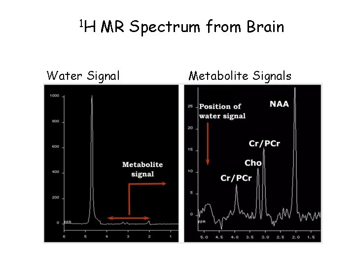 1 H MR Spectrum from Brain Water Signal Metabolite Signals 