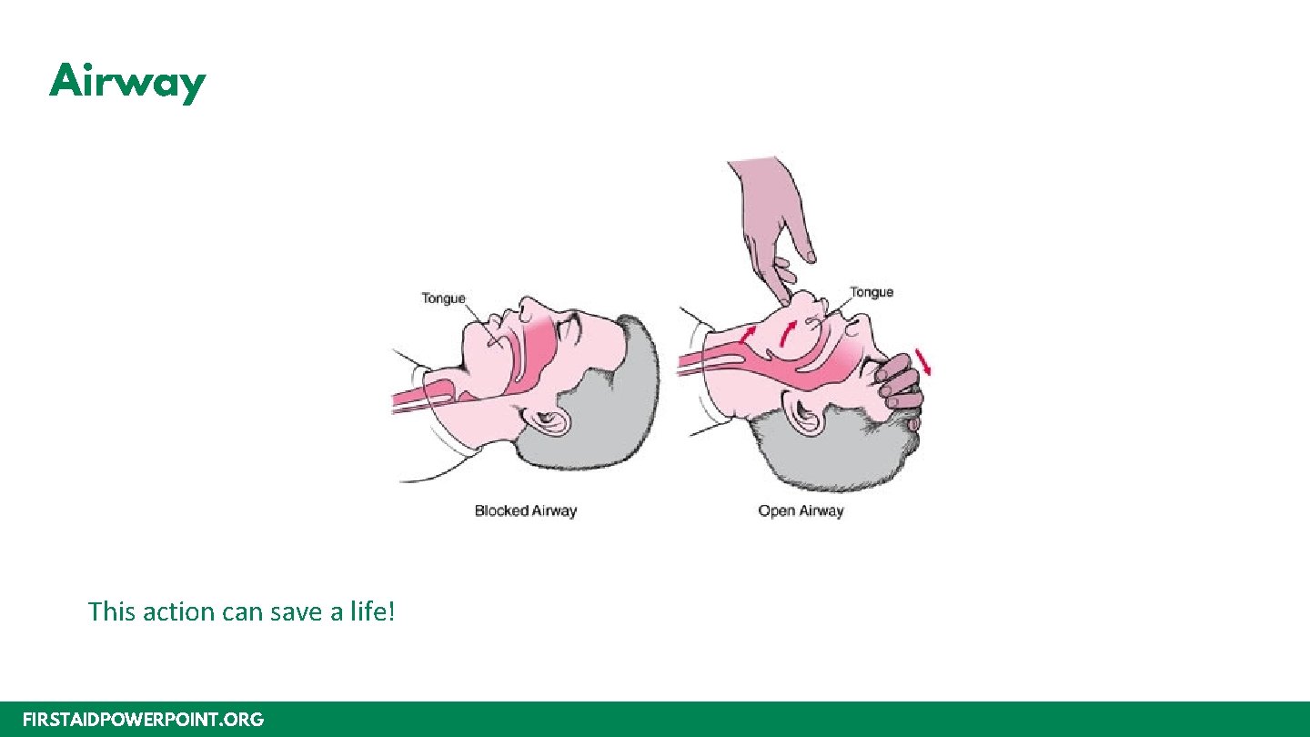 Airway This action can save a life! FIRSTAIDPOWERPOINT. ORG 