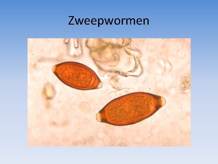 Zweepwormen 
