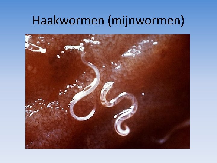 Haakwormen (mijnwormen) 