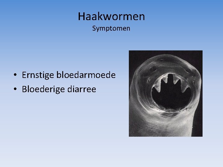 Haakwormen Symptomen • Ernstige bloedarmoede • Bloederige diarree 