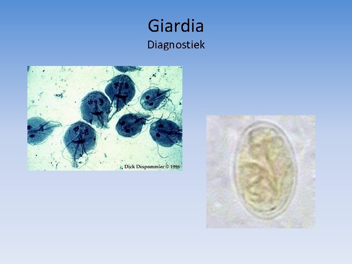 Giardia Diagnostiek 