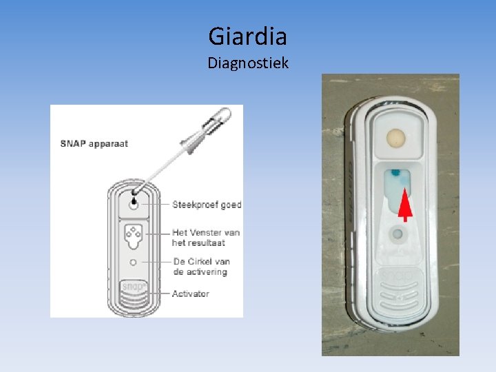 Giardia Diagnostiek 