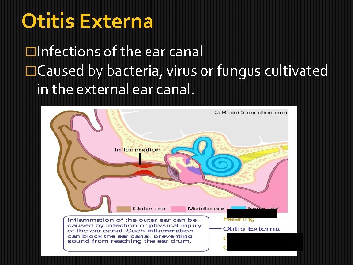 Otitis Externa �Infections of the ear canal �Caused by bacteria, virus or fungus cultivated