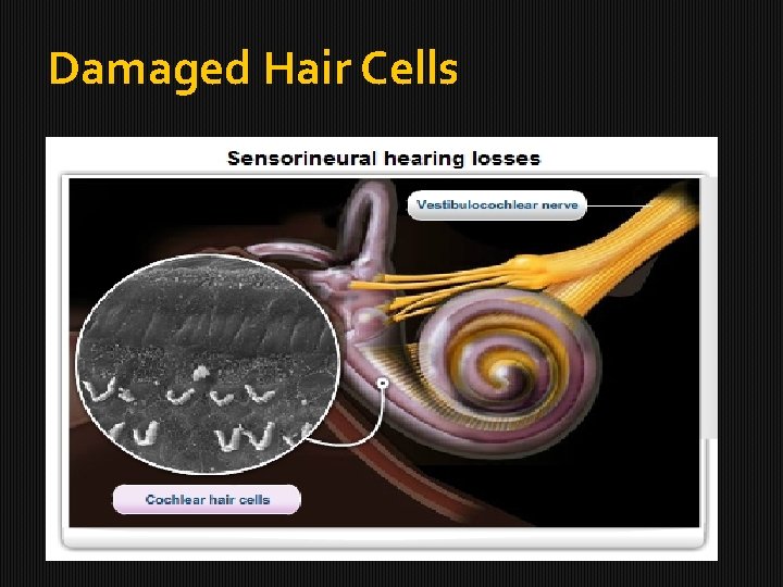 Damaged Hair Cells 