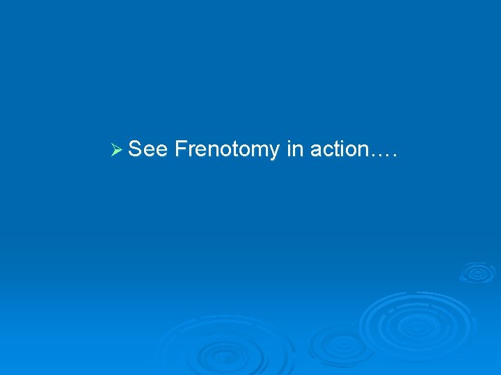 Ø See Frenotomy in action…. 