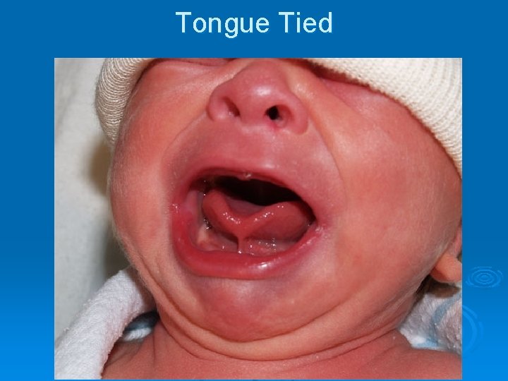 Tongue Tied 