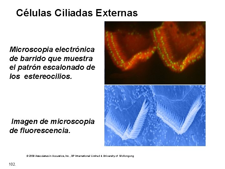 Células Ciliadas Externas Microscopia electrónica de barrido que muestra el patrón escalonado de los