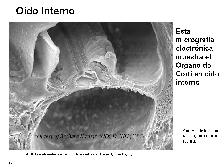 Oído Interno Esta micrografía electrónica muestra el Órgano de Corti en oído interno Cortesia