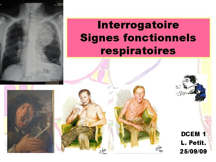 Interrogatoire Signes fonctionnels respiratoires DCEM 1 L. Petit. 25/09/09 