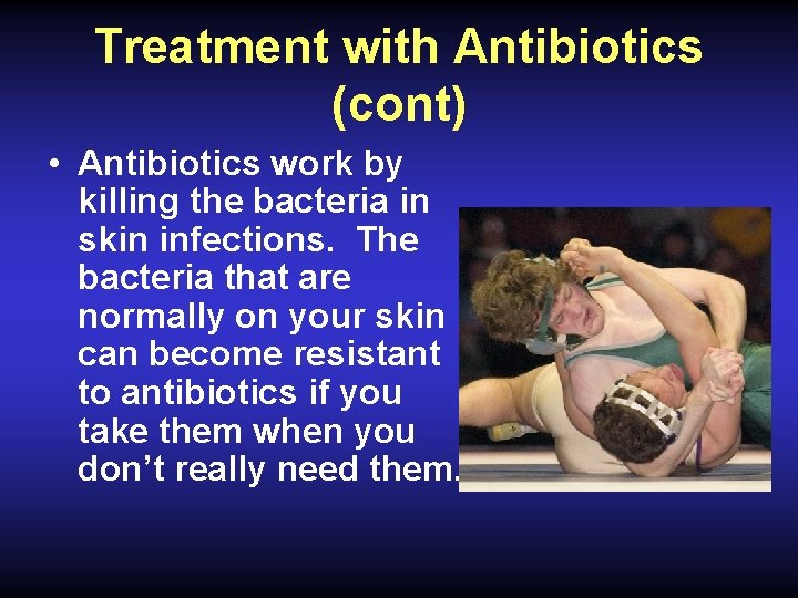 Treatment with Antibiotics (cont) • Antibiotics work by killing the bacteria in skin infections.