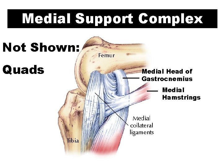 Medial Support Complex Not Shown: Quads Medial Head of Gastrocnemius Medial Hamstrings 
