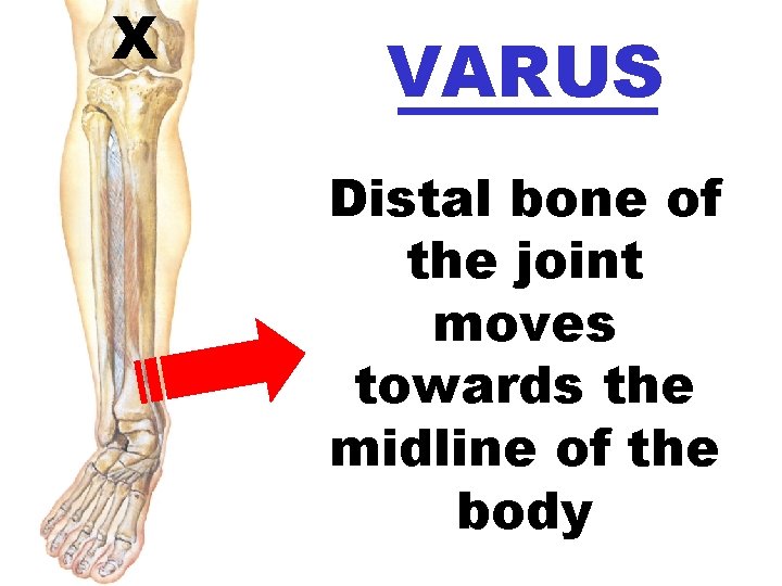 X VARUS Distal bone of the joint moves towards the midline of the body