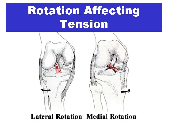 Rotation Affecting Tension 