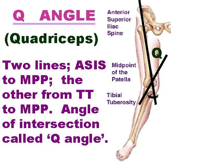 Q ANGLE (Quadriceps) Two lines; ASIS to MPP; the other from TT to MPP.