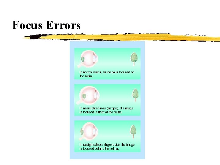 Focus Errors 