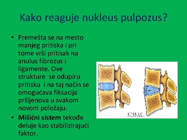 Kako reaguje nukleus pulpozus? • Premešta se na mesto manjeg pritiska i pri tome