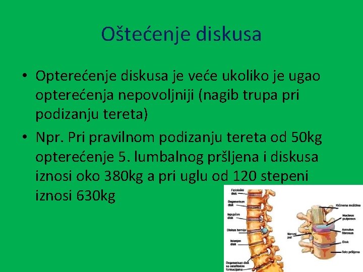 Oštećenje diskusa • Opterećenje diskusa je veće ukoliko je ugao opterećenja nepovoljniji (nagib trupa