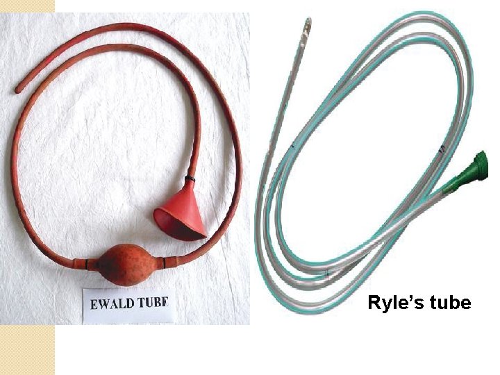Ryle’s tube Ryle’s tube