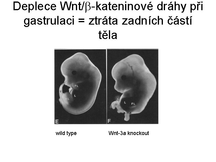 Deplece Wnt/ -kateninové dráhy při gastrulaci = ztráta zadních částí těla wild type Wnt-3