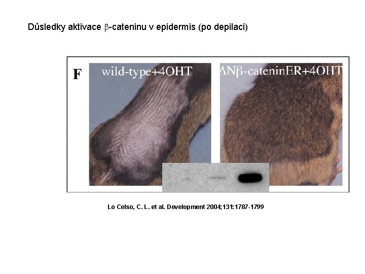 Důsledky aktivace -cateninu v epidermis (po depilaci) Lo Celso, C. L. et al. Development