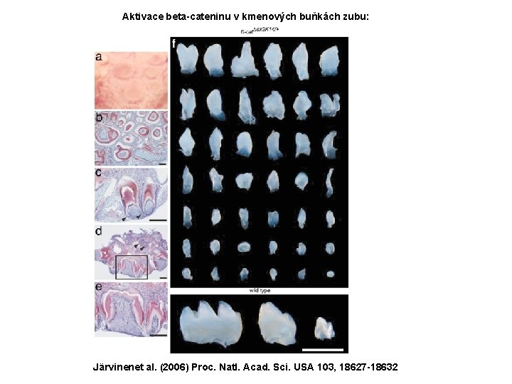 Aktivace beta-cateninu v kmenových buňkách zubu: Järvinenet al. (2006) Proc. Natl. Acad. Sci. USA