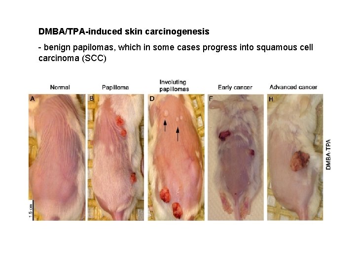 DMBA/TPA-induced skin carcinogenesis - benign papilomas, which in some cases progress into squamous cell