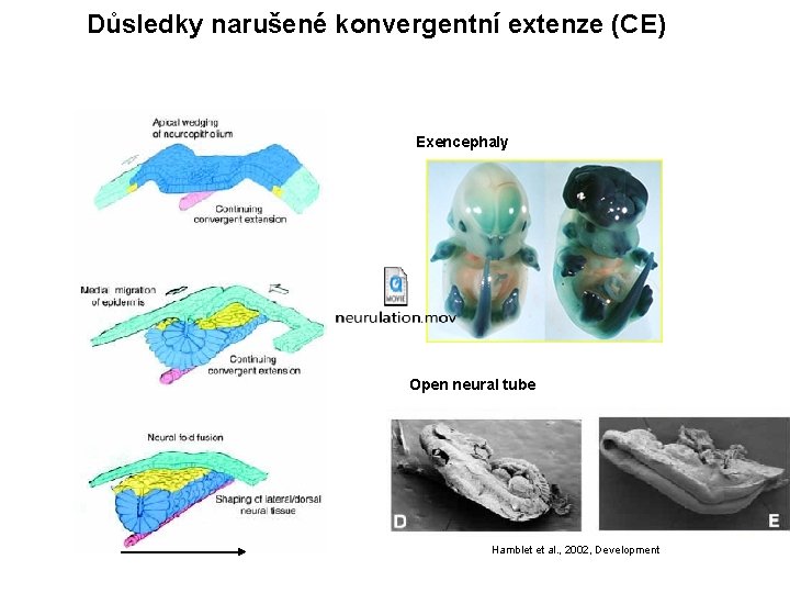 Důsledky narušené konvergentní extenze (CE) Exencephaly Open neural tube Hamblet et al. , 2002,