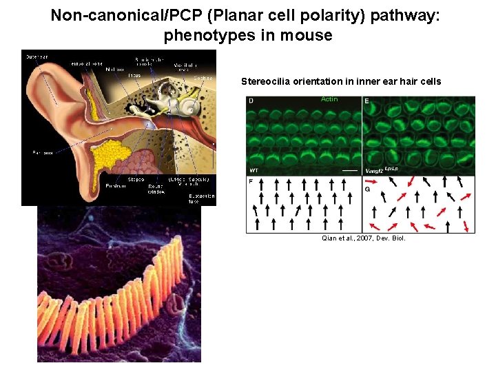 Non-canonical/PCP (Planar cell polarity) pathway: phenotypes in mouse Stereocilia orientation in inner ear hair