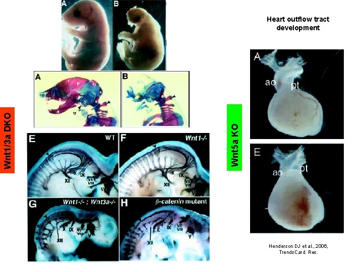 Wnt 5 a KO Wnt 1/3 a DKO Heart outflow tract development Henderson DJ