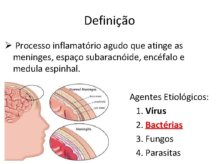 Definição Ø Processo inflamatório agudo que atinge as meninges, espaço subaracnóide, encéfalo e medula