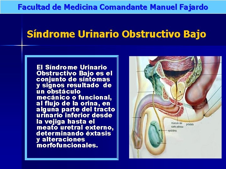 Facultad de Medicina Comandante Manuel Fajardo Síndrome Urinario Obstructivo Bajo El Síndrome Urinario Obstructivo