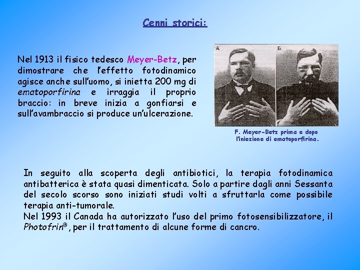 Cenni storici: Nel 1913 il fisico tedesco Meyer-Betz, per dimostrare che l’effetto fotodinamico agisce